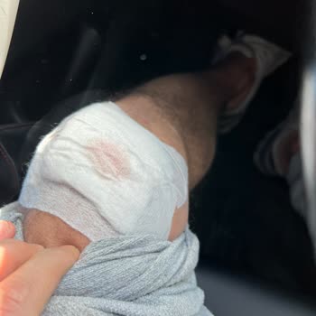 Manisa Büyükşehir Belediyesi M***** K****** Başıboş Köpek Saldırısı