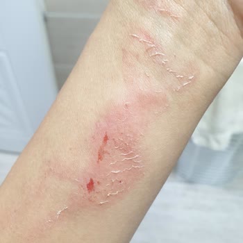 Nakkaş Kebap Bebeklerim Ve Ben Neredeyse Ölüyorduk