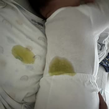 Molfix Kaka Ve Çiş Sızdırıyor Kaçırıyor