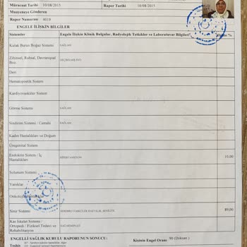 Üsküdar Devlet Hastanesi Akıl Sağlığının Tespiti