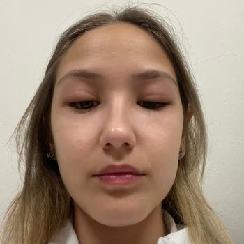 Bee Beauty Pirinç Özü Maske Göz Kapaklarımı Şişirdi