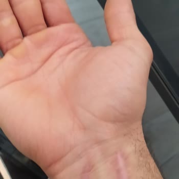 Şanlıurfa Mehmet Akif İnan Eğitim Ve Araştırma Hastanesi Randevu Alamıyoruz