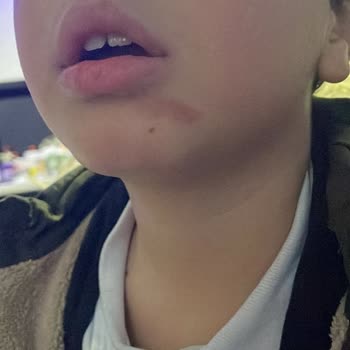 Milli Eğitim Bakanlığı (MEB) Çocuğuma Okulda Yanlış Muamele