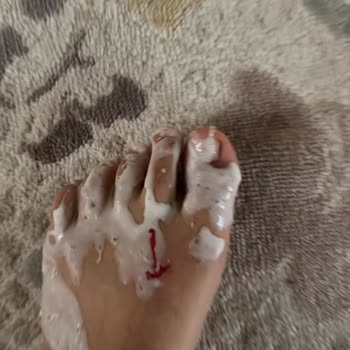 Beko Markalı Doğrayıcı Patladı Ve Ayağıma Camı Saplandı...