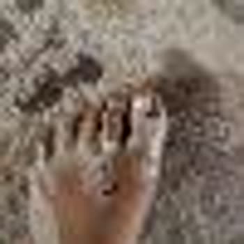 Beko Markalı Doğrayıcı Patladı Ve Ayağıma Camı Saplandı...