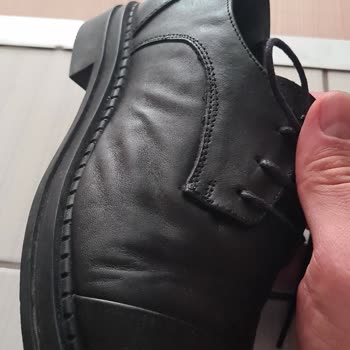 Derimod Ayakkabının Şeklinde Bozukluk
