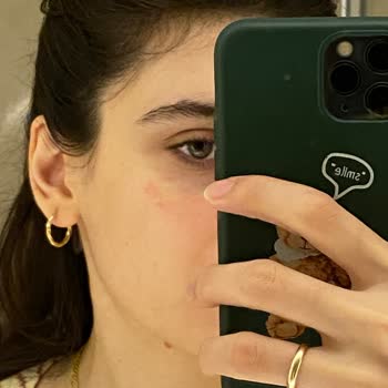 Watsons Frudia C Vitamin Serum Meğer Bozukmuş!