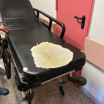 Afyonkarahisar Devlet Hastanesinin Acı Durumu