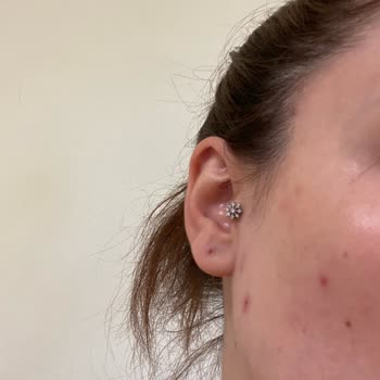 Missha Güneş Kremi Sivilce Yaptı