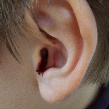 Bahçeşehir Koleji Okulda Şiddet Var!