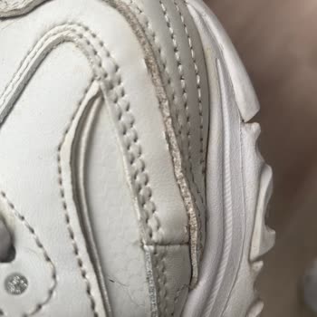 Skechers Ayakkabı Deri Soyulması
