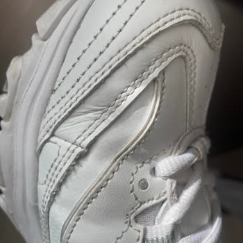 Skechers Ayakkabı Deri Soyulması