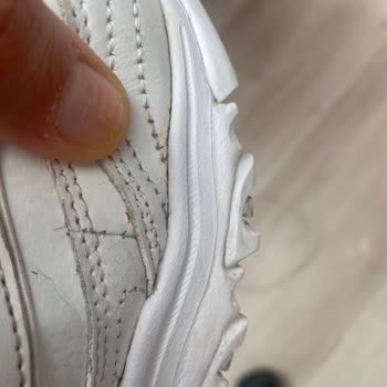 Skechers Ayakkabı Deri Soyulması