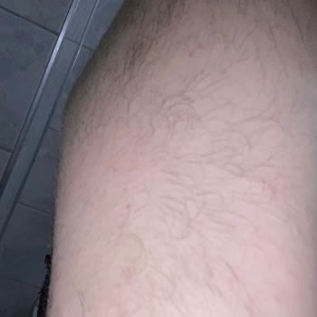 Sayannemis Güzellik Merkezi Rosso Güzellik Merkezi Lazer Memnuniyetsizliği