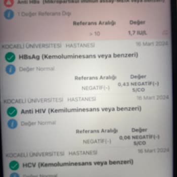 Türk Kızılay Kanımdaki Red Kalksın