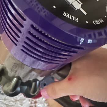 Dyson V10 Şikayetçiyim Elimi Yara Yaptı