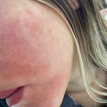 Selin Beauty BB Krem Yüzümü Mahvetti!
