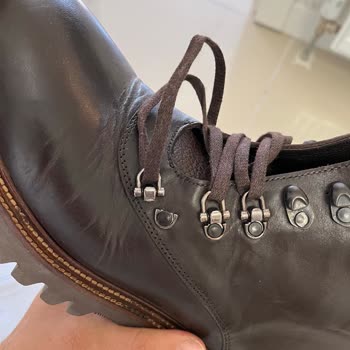 Tergan-Ayakkabıdan Kopan Metal Düğme İçin "müşteri Koparmış" Dediler.