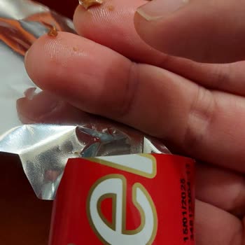 Sagra Tadelle, Diş Parçalayan Yabancı Cisim Ve Firma İlgisizliği