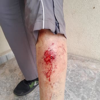 Maltepe Belediyesi Maltepe'deki Saldırgan Sokak Köpekleri
