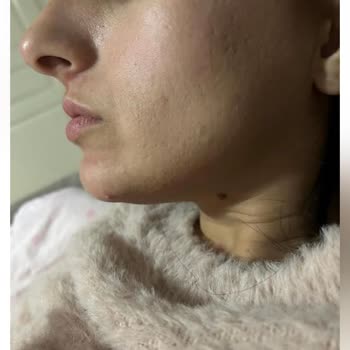 Duygu Savaş Hair & Make Up İstanbul'da Bir Güzellik Merkezinde Yaşanan Epilasyon Sorunu