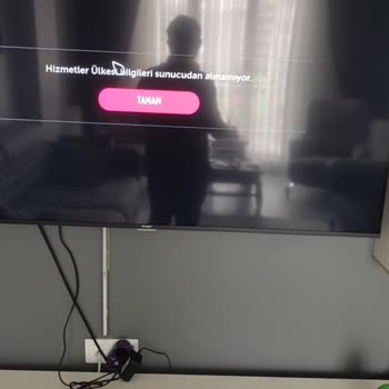 Axen Bein Problemi Öncü Elekt. Kötü Hizmet