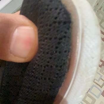 Yeni Skechers Ayakkabım Hızla Deforme Oldu Ve Bayiden Yeterli Destek Alamadım