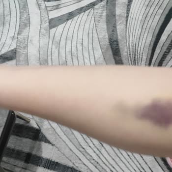 Markasi Hospital Güya Özel Olan Markası Hastanesi