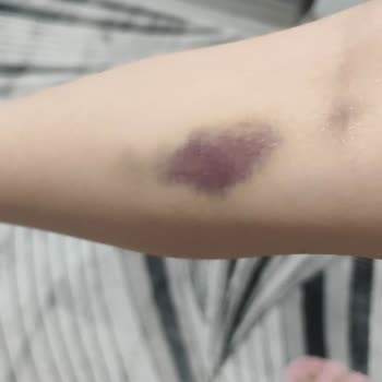 Markasi Hospital Güya Özel Olan Markası Hastanesi