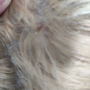 Palette Deluxe Ultra Açıcı