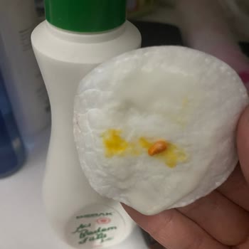 Bebak Acıbadem Sütü Yabancı Madde