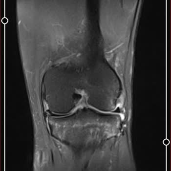 Silivri Devlet Hastanesi Sağlık Sorunu İşsizlik!