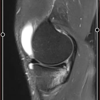 Silivri Devlet Hastanesi Sağlık Sorunu İşsizlik!