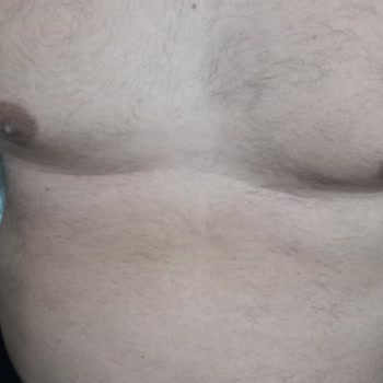 Lavinya Golden Antalya Azalmayan Vücut Kılı Ve Kol Yanığı