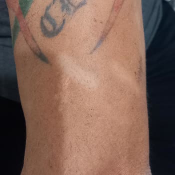 Lavinya Golden Antalya Azalmayan Vücut Kılı Ve Kol Yanığı