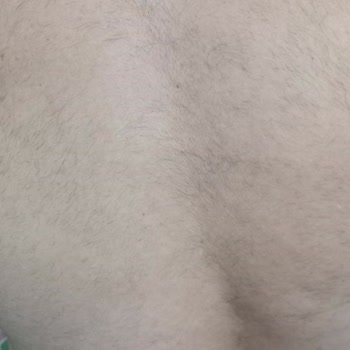 Lavinya Golden Antalya Azalmayan Vücut Kılı Ve Kol Yanığı