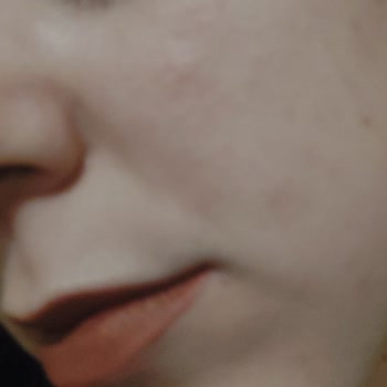 Dermoeczanem İade Seçeneği Yok!