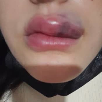 Cosmotolog Bybeyza Hekim Olmadığını Anladım Maalesef Geç Oldu!