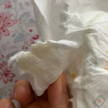 Molfix Bezin İçinden Sakız Çıktı