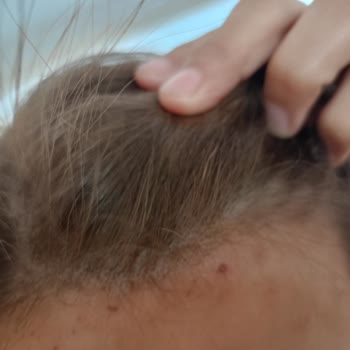 Filiz Yıldız Aktaş Kuaför Saç Boyattım