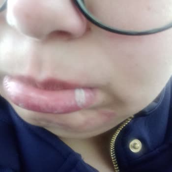 Sağlık Bakanlığı Devlet Diş Hastanesi İlgisizliği