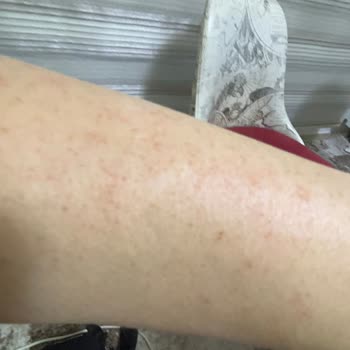 Trendyol Ürün Sağlık Açısından Zararlı