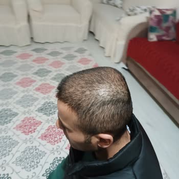 Estecenter Saç Ekimi İlgisizliği