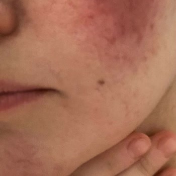 Aris Ezgi Doğan Polikliniği Cilt Bakımında Beklenmedik Sonuçlar