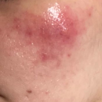 Aris Ezgi Doğan Polikliniği Cilt Bakımında Beklenmedik Sonuçlar