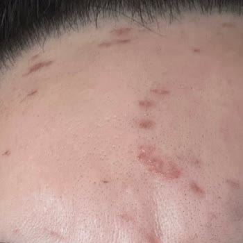 Kübra Öztürk Beauty Lounge Vıp Medikal Cilt Bakımı