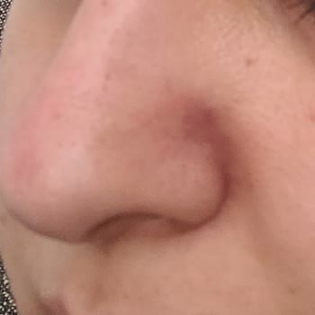 Kübra Öztürk Beauty Lounge Vıp Medikal Cilt Bakımı