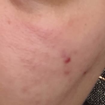 Kübra Öztürk Beauty Lounge Vıp Medikal Cilt Bakımı