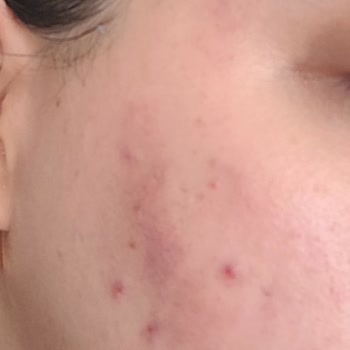 Kübra Öztürk Beauty Lounge Vıp Medikal Cilt Bakımı