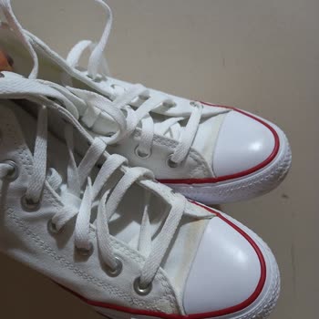 Converse Ayakkabıda Sarartılar Oluşması